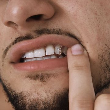 profesjonalne tooth gems