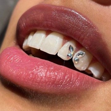 Tooth gems