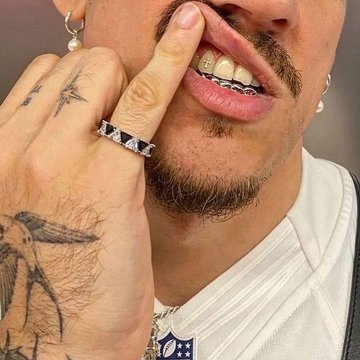 Tooth gems