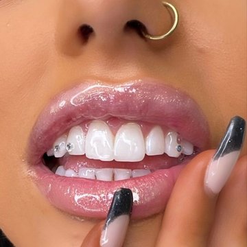 Tooth gems