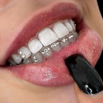 Tooth gems