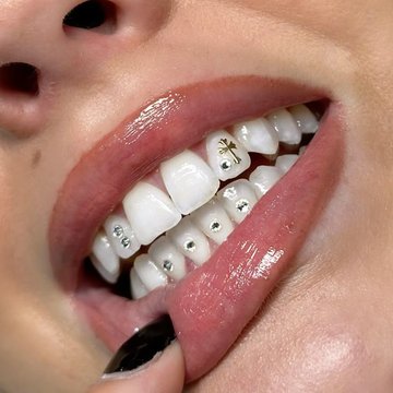 profesjonalne tooth gems